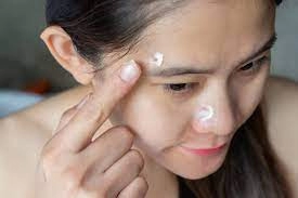 How to Apply Benzoyl Peroxide ?